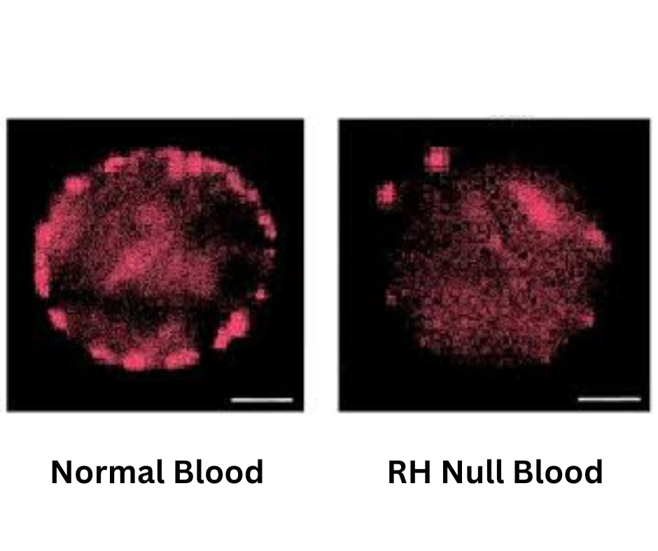 what is rh-null blood: 