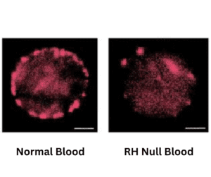 rare blood types